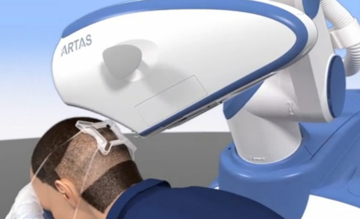 ARTAS Robot