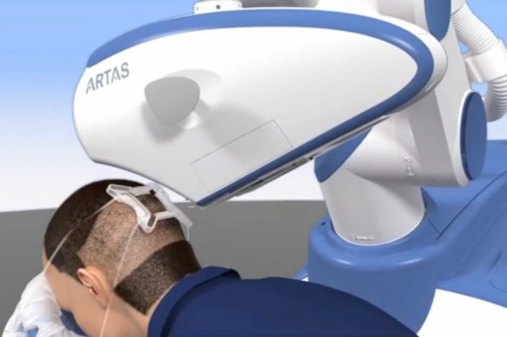 ARTAS Robot